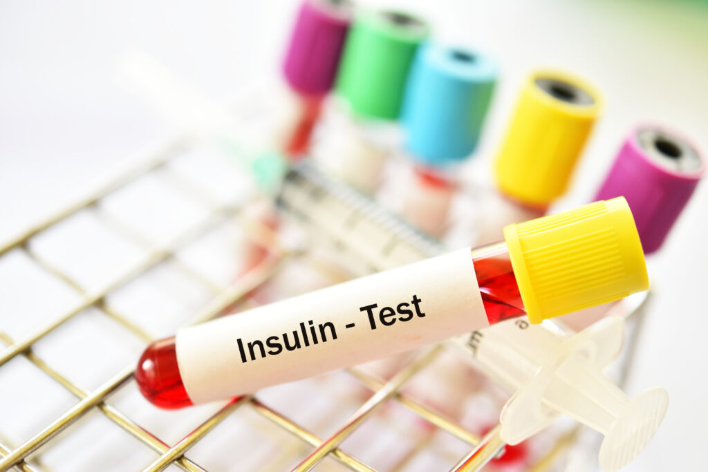 Why You Should Get Your Fasting Insulin Checked: Insulin Levels Are ...